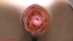 Abspielen Public Toilet Anal Prolapse: Pinkeln Sie MILFs klappiges Arschloch